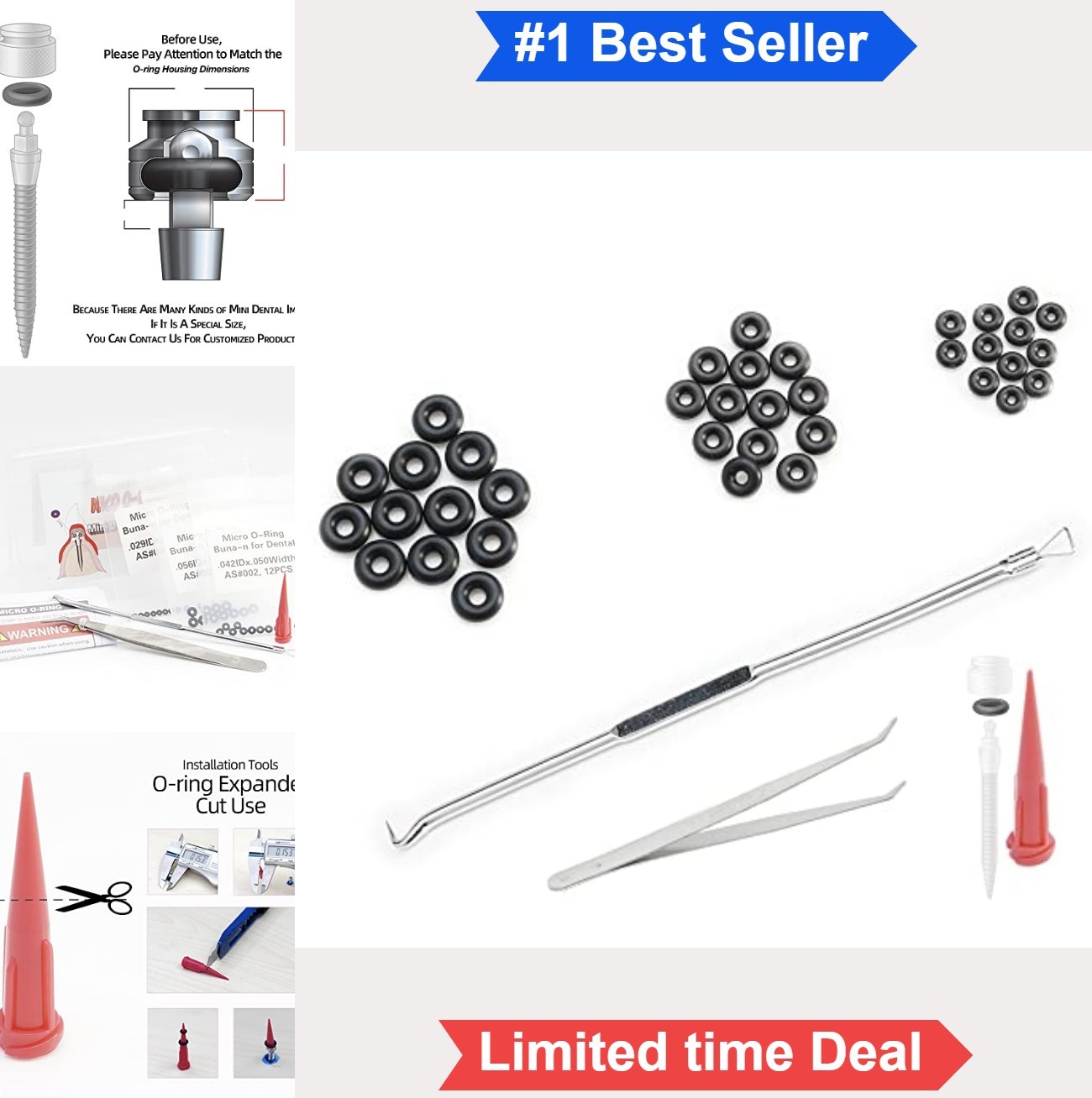 O-Ring Buna-n Tool Kit 36 Piece Mini Dental Implant Replacement 3 Sizes