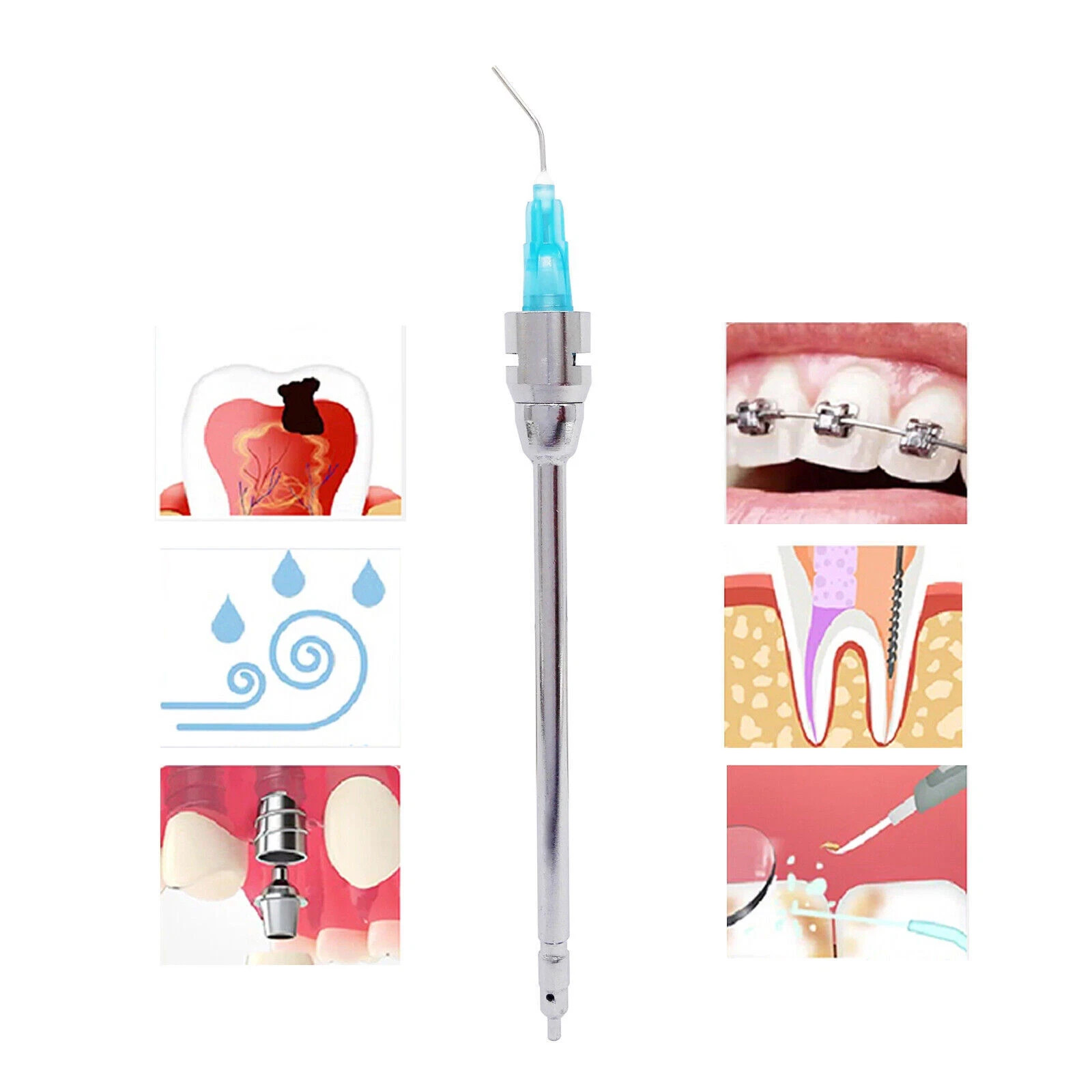Dental Kerr Sybronendo Stropko Style 90mm Air Water Irrigation Syringe Tips