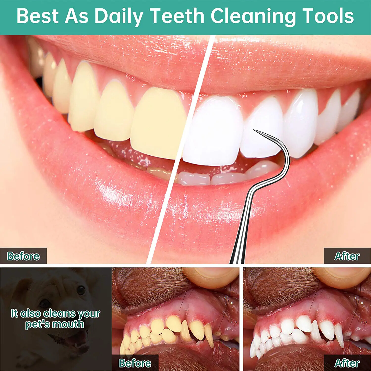 Professional Dental Scraper Tool – Dentist Pick, Medical Stainless Steel, Dental