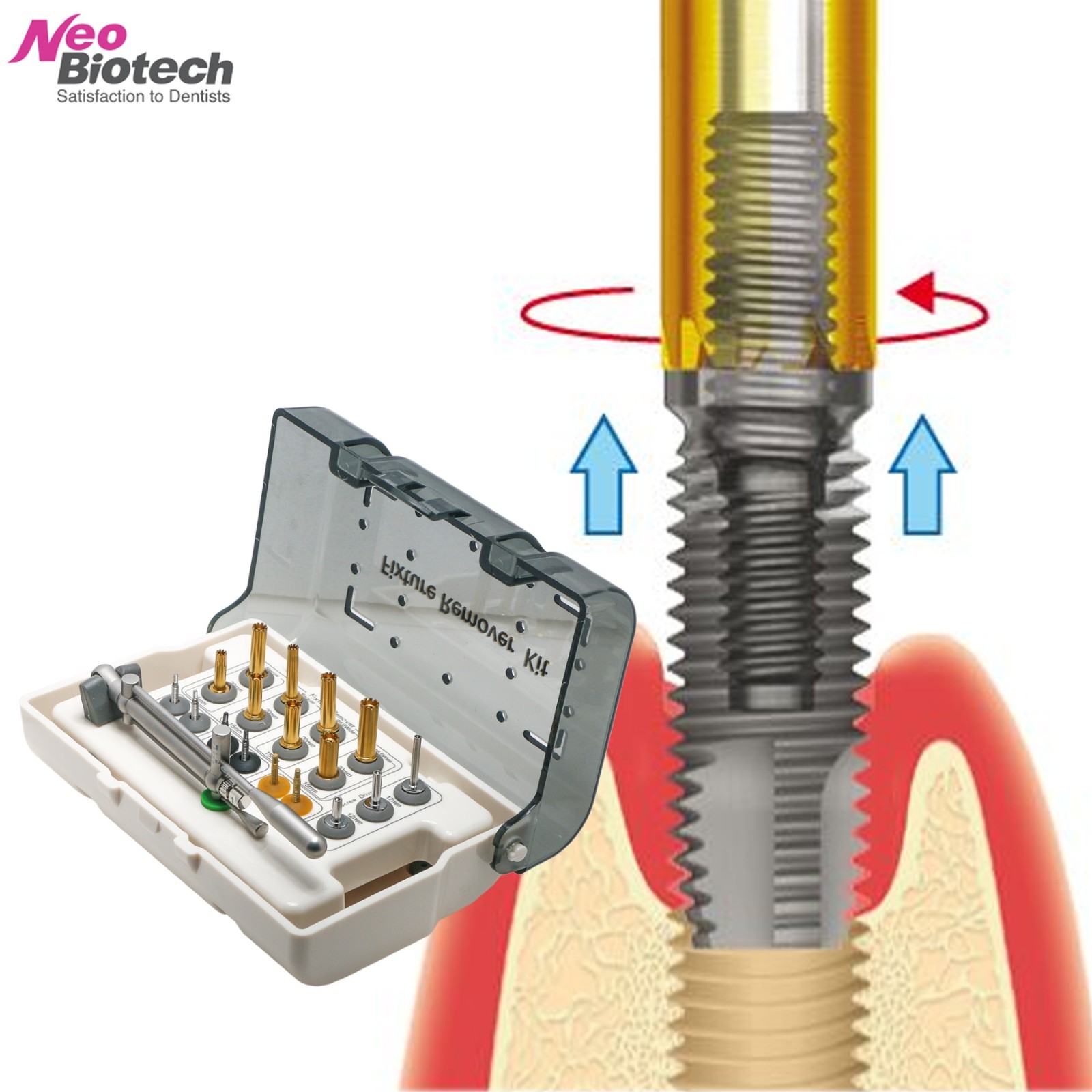 Neo FR Implant Fixture Removal Kit Dental Screw Hex Driver Neobiotech FR Wrench